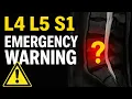 WARNING These Are The 3 MAJOR Symptoms of a Severe L4 L5 L5 S1 Disc Bulge Dr Walter Salubro