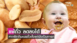 ทำไมการให้ทารกอายุ 4-6 เดือน กินถั่วลิสงในปริมาณเล็กน้อยจึงช่วยลดความเสี่ยงการแพ้ถั่วเมื่อโตขึ้น