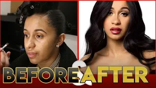 CARDI B BEFORE AFTER TRANSFORMATION Plastic Surgery