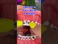 Download Lagu WHAT TO DO IF YOU BREAK A BRACKET / BRACES OFF TIPS 🦷 IF WAX DOESN'T WORK ORTHODONTIST REACTS