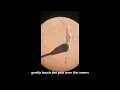 C elegans 101 A Guide to Picking C elegans