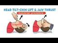 Jaw thrust Head tilt - Chin lift maneuver Explanation