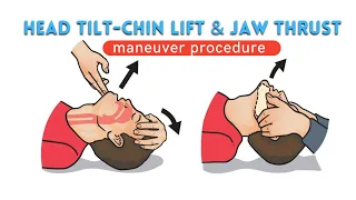 Jaw thrust Head tilt - Chin lift maneuver Explanation