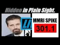 LIVE SITUATION-CRITICAL I AM OUT OF THE STOCK MARKET MMRI Breaks 300 Mannarino