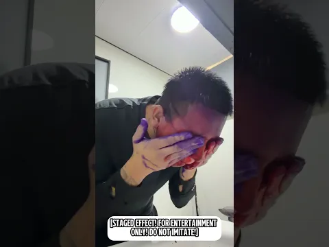 He Tried Using Red Medicine to Wash Off Purple Dye