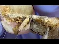 Download Lagu 😍 Fungus Toenail Deep Cleaning \u0026 Removal | Natural ASMR Rain Sounds for Relaxation ~Medical Pedicure