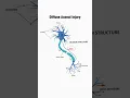 What is diffuse axonal injury relating to Traumatic Brain Injury