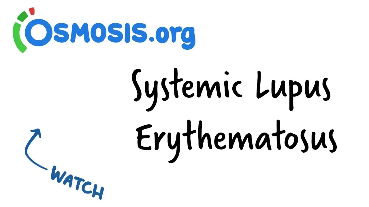 Systemic Lupus Erythematosus | Clinical Presentation
