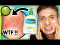 I tried the Cetaphil MOISTURIZING CREAM LOTION for ONE WEEK It broke me out