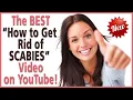 Scabies Treatment - How to Get Rid of Scabies 2026