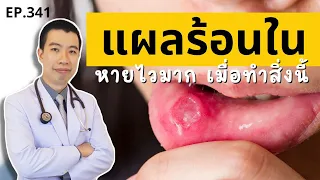 แปรงสีฟันที่ไม่เหมาะสมสามารถทำให้เกิดแผลร้อนในได้หรือไม่?