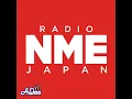 #76 アフタートーク～ハリー・スタイルズが東京マラソンに襲来、ライブ持ち込み規制の考え方～
