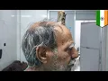 Four-inch devil horn removed from Indian man s head - TomoNews