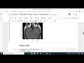 Brain Tumor Classification MRI Brain Tumor Detection using Support Vector Machine in Python