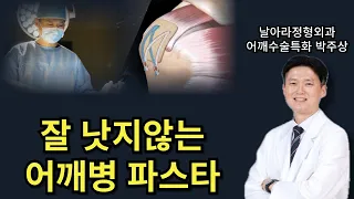 잘 낫지 않는 어깨병, 어깨통증 파스타