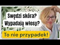 Download Lagu Zaczyna się od swędzenia… a potem lecą włosy. Jak to zatrzymać?