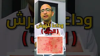 لازم كل البيت ياخد العلاج  الجرب  دندنها