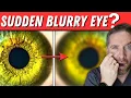 Download Lagu Sudden Blurry Vision In One Eye?! (5 Causes)