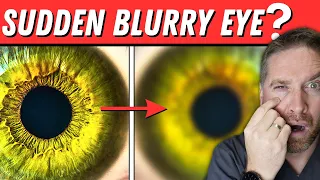 sudden blurry vision in one eye 5 causes 
