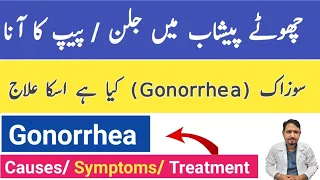gonorrhea causes symptoms and treatment in urdu hindi gonorrhea ka ilaj suzak ka ilaj irfan azeem