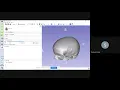 Slicer Tutorial Threshold Segmentation and Generation of 3D model in STL
