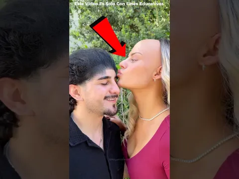 Su Esposa Tenía Una Frente Enorme 😱