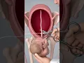How a Baby Is Born | 3D Animation of the Birth Process 👶✨