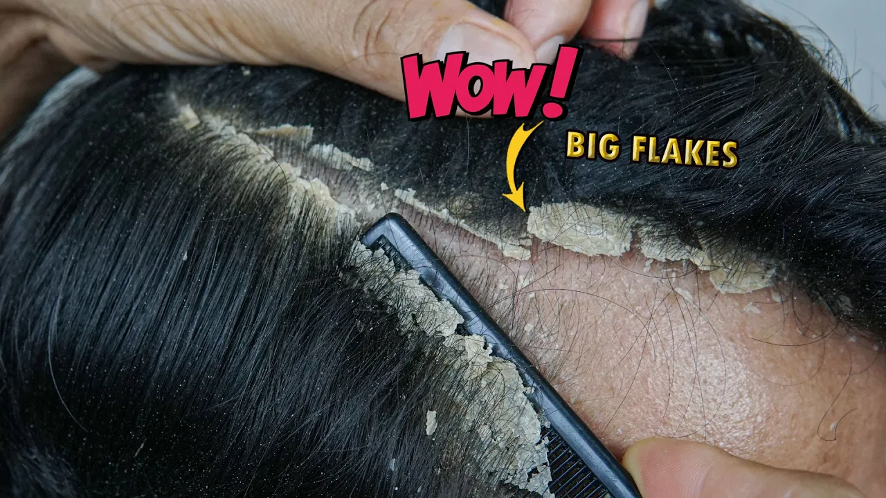 How To Increase Glutathione Naturally Using NAC Supplement | Supplements for Grey Hair Reversal