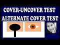 Cover Tests Explained Squint Simplified for Medical Students