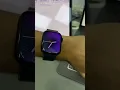 Download Lagu WatchOS 11 | Watch Faces are next level!! #applewatch