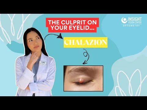 Why Do Eyelid Bumps Occur? Understanding Chalazions and Eye Health