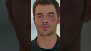 جاءت ردة فعل كبيرة من براق رائحة الفراولة Shorts 