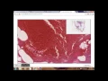 Digital Pathology Viewer