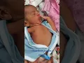 How a Paediatrician check jaundice clinically in neonates.