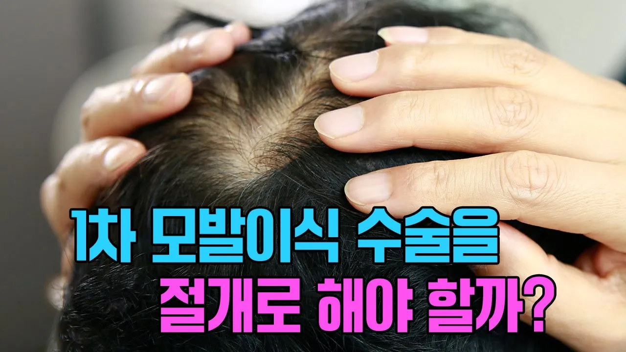 의느님답변📂남자 환자에서 1차 수술을 꼭 절개로 해야 할까?ㅣ다나성형외과(DANA)ㅣ모발이식ㅣ헤어라인교정ㅣ두피문신ㅣ탈모치료