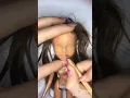 Bratz doll repaint with vitiligo