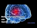 Brain Tumor Segmentation with OpenCV-python