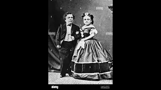 The Difference Between Dwarfism and Midgets - A Clear Explanation