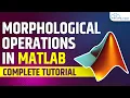 What are Erosion and Dilation in Image Processing MATLAB MATLAB Tutorial