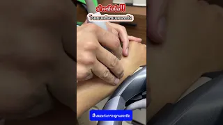  อาการเจ็บปวดและบวมที่ข้อเท้าด้านใน มีสาเหตุจากอะไร 
