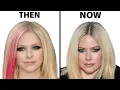 Download Lagu Did Avril Lavigne Have Plastic Surgery? | Plastic Surgery Analysis