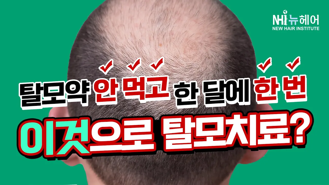 탈모약 안 먹고 OO로 탈모치료? - 뉴헤어 I 탈모치료
