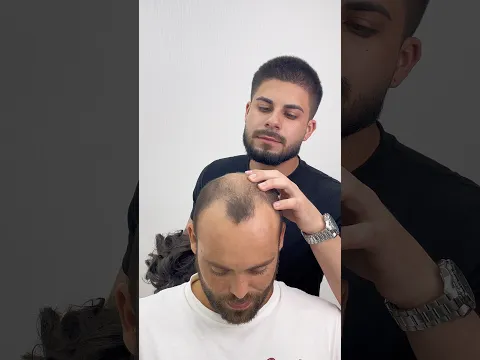 ANTES X DEPOIS