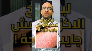 علاج الاكزيما الحادة دندنها