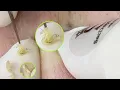 Download Lagu Pimples And Ingrown Hair P2 | Lông Mọc Ngược Gây Mụn P2 - SacDepSpa#228