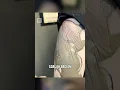 Download Lagu Mengapa Cairan Keluar dari Tato Baru?