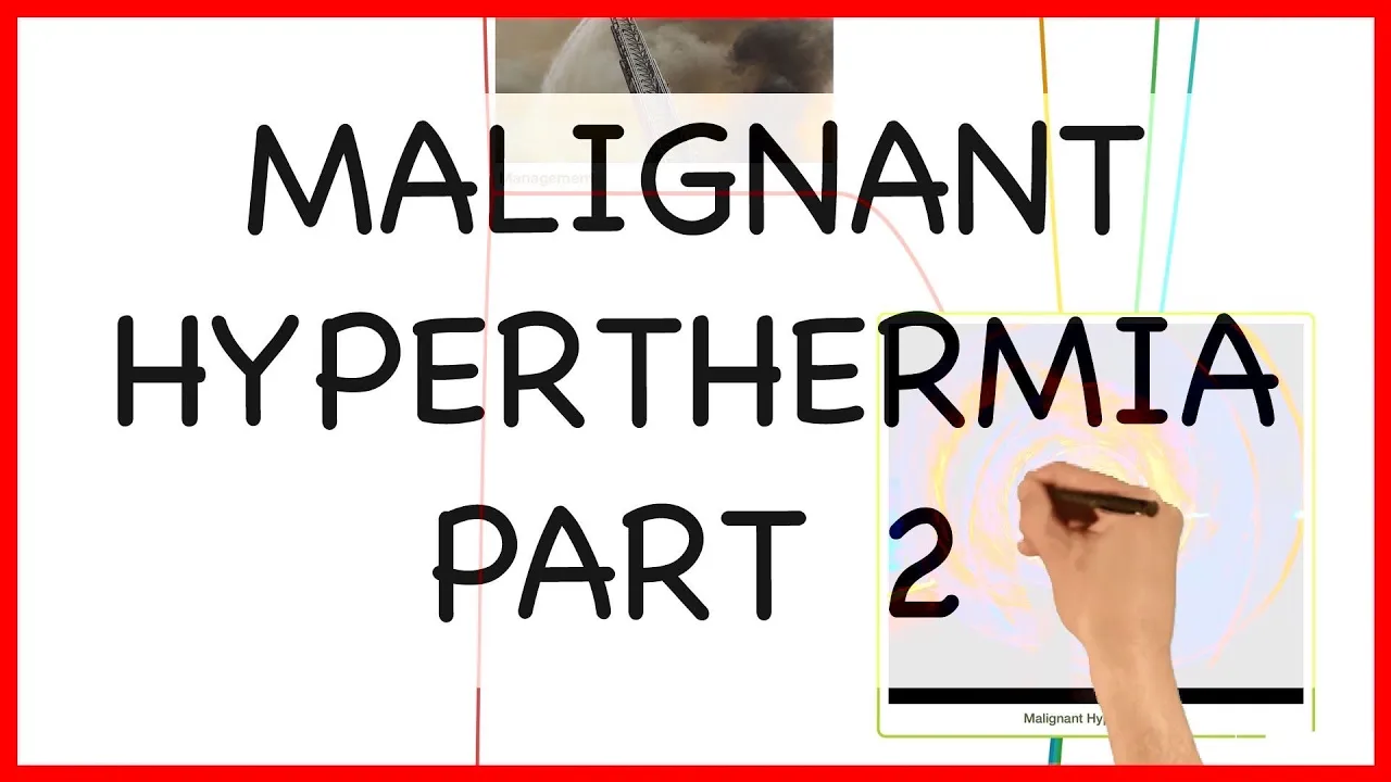 MALIGNANT HYPERTHERMIA PART 2 -PRACTICAL CONDUCT SERIES