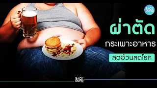 การผ่าตัดลดน้ำหนักทำอย่างไรและมีผลต่อร่างกายอย่างไร