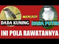 Lagu Cara merubah dada ciblek dari kuning sampe putih