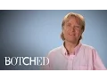Man Wins 100 000 Breast Implants Bet Botched E
